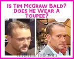 Is Tim McGraw Bald and does he wear a Toupee