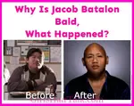 Why Is Jacob Batalon Bald?