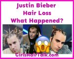 Justin-Bieber-Hair-Loss.jpg